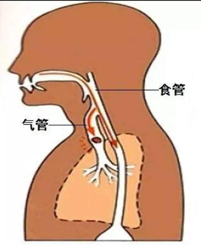 食管.jpg