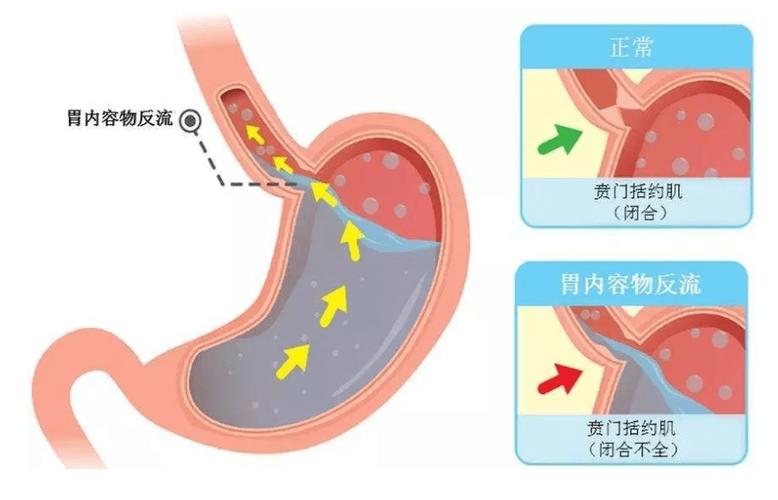 孕妇产后出现便秘的危害有哪些
