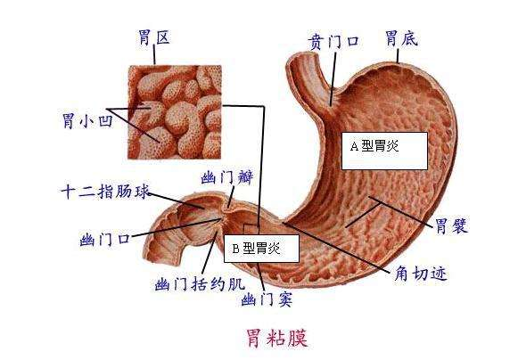 饭后嚼口香糖可预防胃酸反流