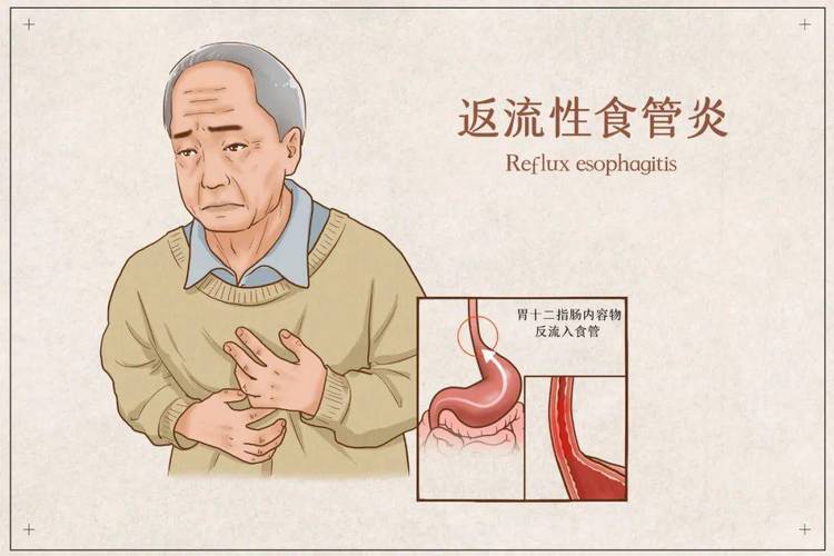 胃镜检查有什么需要注意的呢？