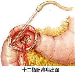 中医是如何认识口臭