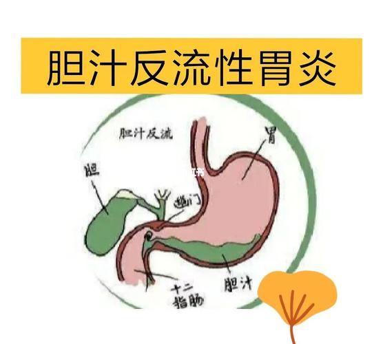 胃镜检查有什么需要注意的呢？