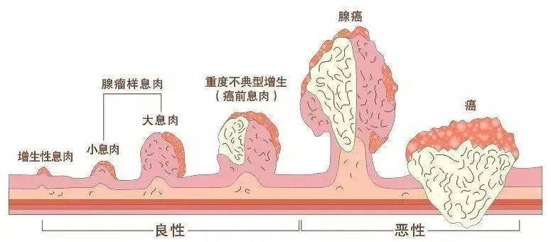 胃酸过多自己如何调理
