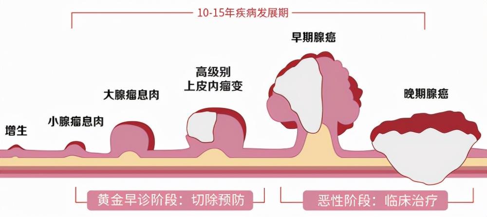 直肠炎的病因有哪几点？