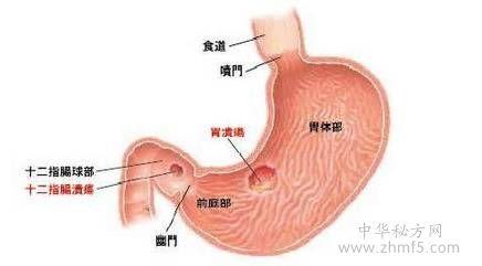 胆汁反流性胃炎的危害是什么