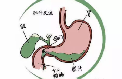胃难受怎么办